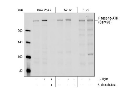 Western blot analysis of Raw264.7, SV-T2 and HT-29 cells that were untreated or UV-treated (50 mJ, 30 min), using Phospho-ATR (Ser428) Antibody. Lambda phosphatase NEB #P0753 (10,000 Units/ml, 1hr) was used to demonstrate the phospho-specificity of the antibody.