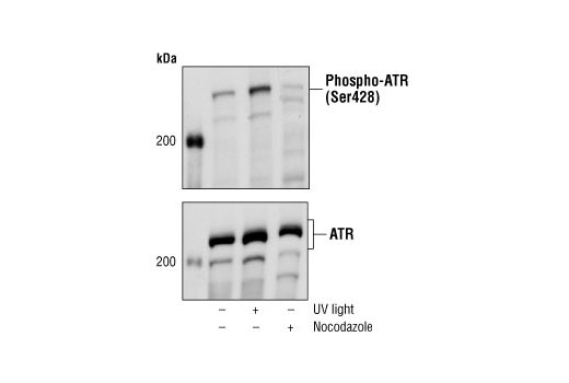 Western blot analysis of untreated, UV-treated (50 mJ, 30 min) and nocodazole-treated (50 ng/ml, 24hr) Raw264.7 cells, using Phospho-ATR (Ser428) Antibody (upper) and a total ATR antibody (lower).