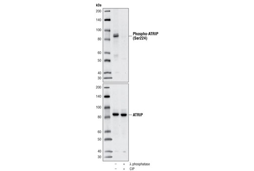 Western blot analysis of extracts from 293T cells, untreated or treated with λ and calf intestinal phosphatases, using Phospho-ATRIP (Ser224) Antibody (upper) or ATRIP Antibody #2737 (lower).
