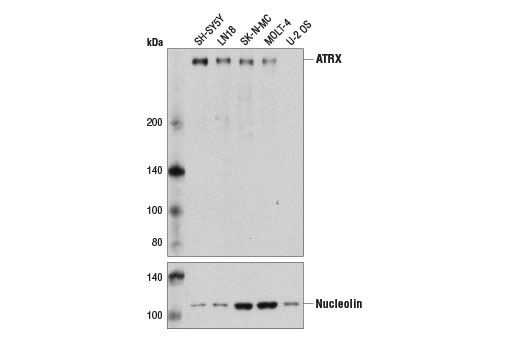Western blot analysis of extracts from various cell lines using ATRX (D1N2E) Rabbit mAb (upper) and Nucleolin (D4C7O) Rabbit mAb #14574. As expected, the signal for ATRX is not present in the negative cell line U2OS.
