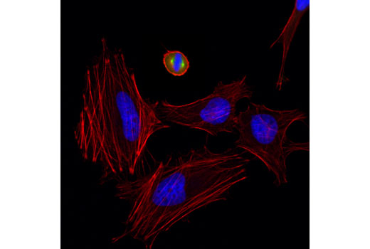 Confocal immunofluorescent analysis of HeLa cells using Aurora A (D3E4Q) Rabbit mAb (green). Actin filaments were labeled with DyLight™ 554 Phalloidin #13054 (red). Blue pseudocolor = DRAQ5 ® #4084 (fluorescent DNA dye).