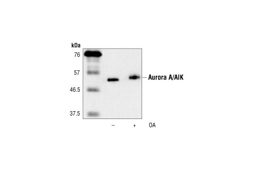 Western blot analysis of purified mouse His-Aurora A/AIK expressed in Sf9 insect cells, untreated or treated with okadaic acid 1 hour prior to harvest, using Aurora A/AIK Antibody.