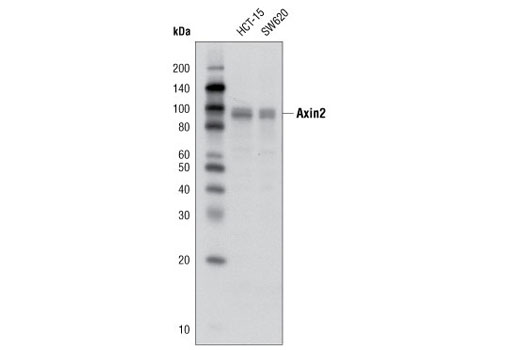 Western blot analysis of extracts from HCT-15 and SW620 cells using Axin2 (D48G4) Rabbit mAb.