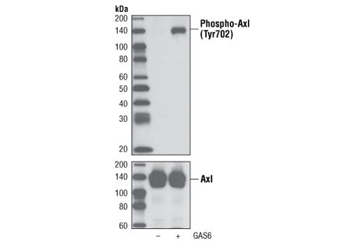 Western blot analysis of extracts from NCI-H1299 cells, untreated or Gas6-treated (100 ng/ml for 10 minutes), using Phospho-Axl (Tyr702) (D12B2) Rabbit mAb (upper) or Axl (C44G1) Rabbit mAb #4566 (lower).