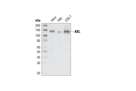 Western blot analysis of cell extracts from various cell lines, using Axl (C2B12) Rabbit mAb.