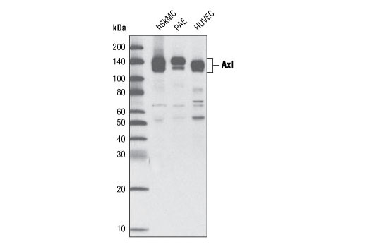 Western blot analysis of extracts from human skeletal muscle cells (hSkMC), PAE and HUVEC cells using Axl (C44G1) Rabbit mAb.