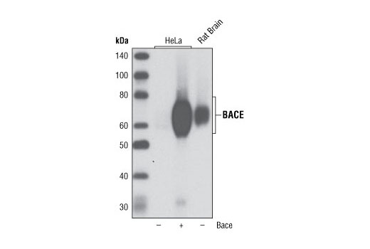 Western blot analysis of extracts from HeLa cells, untransfected and BACE transfected, and rat brain extracts using BACE (D10E5) Rabbit mAb.