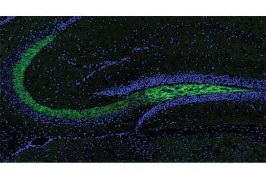Confocal immunofluorescent analysis of mouse hippocampus using BACE (D10E5) Rabbit mAb (green). Blue pseudocolor = DRAQ5® #4084 (fluorescent DNA dye).