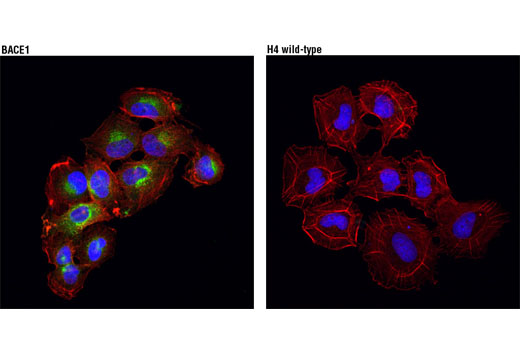 Confocal immunfluorescent analysis of H4 expressing BACE (left), or H4 wild-type, (right) cells using BACE (D10E5) Rabbit mAb (green). Actin filaments were labeled with DyLight ® 554 Phalloidin #13054 (red). Blue pseudocolor = DRAQ5® #4084 (fluorescent DNA dye). (H4 wild type and H4 cells expressing BACE were kindly provided by Dr. Giuseppina Tesco, Tufts University, Boston, MA).