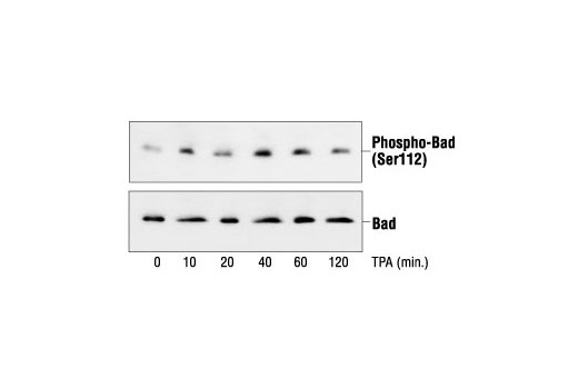 Western blot analysis of extracts from COS cells untreated or TPA-treated, using Phospho-Bad (Ser112) (7E11) Mouse mAb (upper) or Bad Antibody #9292 (lower).