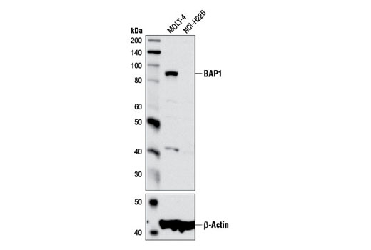 Western blot analysis of extracts from MOLT-4 and NCI-H226 cells using BAP1 (D1W9B) Rabbit mAb (upper) and β-Actin (D6A8) Rabbit mAb #8457 (lower).