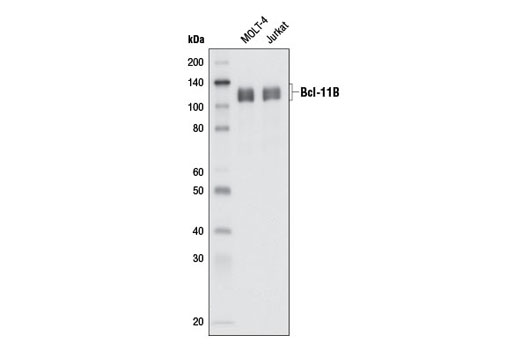 Western blot analysis of extracts from MOLT-4 and Jurkat cells using Bcl-11B (D6F1) XP ® Rabbit mAb.