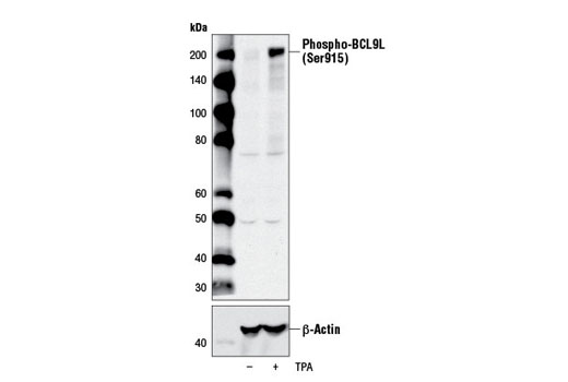 Western blot analysis of extracts from MCF7 cells, untreated (-) or treated with TPA #4174 (200 nM, 30 min; +), using Phospho-BCL9L (Ser915) Antibody (upper) or β-Actin (D6A8) Rabbit mAb #8457 (lower).
