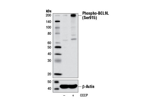 Western blot analysis of extracts from MCF7 cells, untreated (-) or treated with carbonyl cyanide 3-chlorophenylhydrazone (CCCP) (100 μM, 2 hr; +), using Phospho-BCL9L (Ser915) Antibody (upper) or β-Actin (D6A8) Rabbit mAb #8457 (lower).