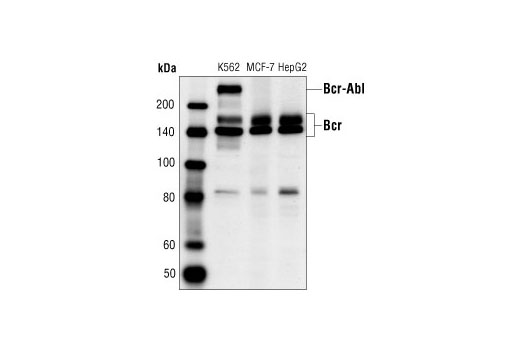 Western blot analysis of extracts from K562, MCF-7 and HepG2 cells, using Bcr Antibody.