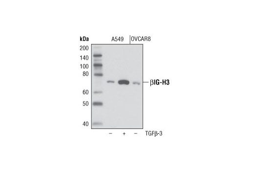 Western blot analysis of extracts from A549 cells treated with hTGFβ-3 #8425 (100 ng/ml for 12 hours) and OVCAR8 cells using βIG-H3 (D31B8) XP ® Rabbit mAb.