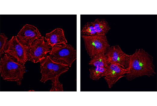 Confocal immunofluorescent analysis of A549 cells, untreated (left) or treated with hTGF-β-1 #8915 (100 ng/ml for 24 hours, right), using βIG-H3 (D31B8) XP ® Rabbit mAb (green). Actin filaments were labeled with DY-554 phalloidin. Blue pseudocolor = DRAQ5 ® #4084 (fluorescent DNA dye).