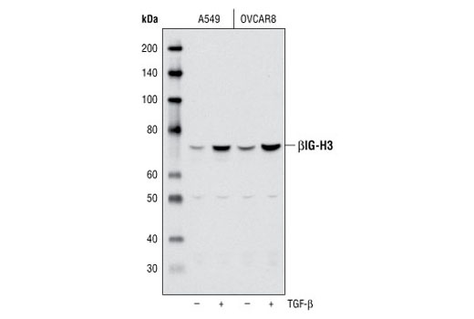 Western blot analysis of extracts from A549 and OVCAR8 cells, untreated or treated with TGF-β overnight, using βIG-H3 Antibody.