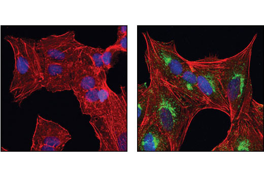 Confocal immunofluorescent analysis of A549 cells, untreated (left) or TGF-β-treated (right), using βIG-H3 Antibody (green). Actin filaments have been labeled with Alexa Fluor ® 555 phalloidin (red). Blue pseudocolor = DRAQ5™ (fluorescent DNA dye).
