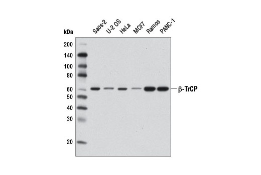 Western blot analysis of extracts from various cell lines using β-TrCP (D12C8) Rabbit mAb.