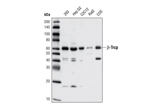 Western blot analysis of extracts from various cell lines using β-TrCP (D13F10) Rabbit mAb.