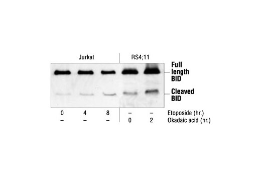 Western blot analysis of extracts from Jurkat cells, untreated or etoposide-treated (25 µM), and RS4;11 cells, untreated or okadaic acid-treated (1 µM), using BID Antibody (Human Specific).