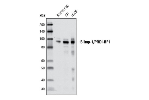 Western blot analysis of extracts from Karpas 620, SR and H929 cell lines using Blimp-1/PRDI-BF1 (C14A4) Rabbit mAb.