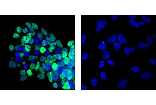 Confocal immunofluorescent analysis of SR (left) and HeLa cells (right) using Blimp-1/PRDI-BF1 (C14A4) Rabbit mAb (green). Blue pseudocolor = DRAQ5™ (fluorescent DNA dye).
