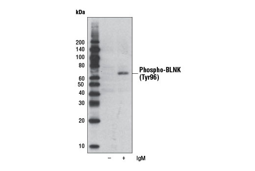Western blot analysis of SDS extracts from control or anti-human IgM treated (12 µg/ml for 2 minutes) Ramos cells using Phospho-BLNK (Tyr96) Antibody.