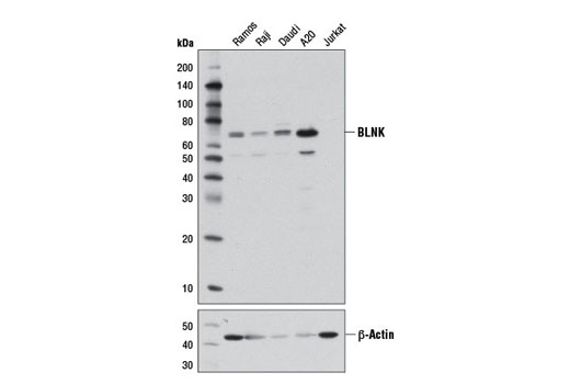 Western blot analysis of extracts from various cell lines using BLNK (D8R3G) Rabbit mAb. B cell specificity of this antibody is demonstrated by the absence of signal in Jurkat cells.