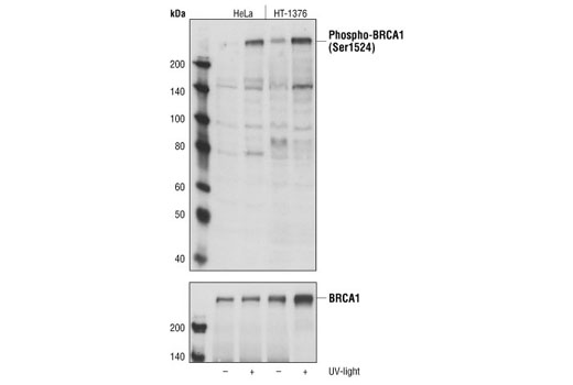 Western blot analysis of untreated and UV-treated (50 mJ/cm2,30 min) HeLa cells and HT-1376 cells, using Phospho-BRCA1 (Ser1524) Antibody (upper) and BRCA1 Antibody #9010 (lower).