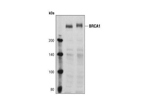 Western blot analysis of untreated and UV-treated (50 mJ/cm2, 30 min) HeLa cells, using BRCA1 antibody.