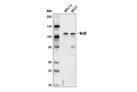 Western blot analysis of extracts from MOLT-4 and NCCIT cells using Brd2 (D89B4) Rabbit mAb.