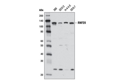 Western blot analysis of extracts from various cell lines using RNF20 (D8C2) Rabbit mAb.