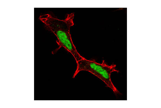 Confocal immunofluorescent analysis of 293 cells using Brg1 (A52) Antibody (green). Actin filaments have been labeled using DY-554 phalloidin (red).