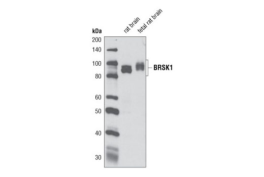 Western blot analysis of extracts from rat and fetal rat brain using BRSK1 (D10F2) Rabbit mAb.