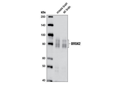 Western blot analysis of extracts from mouse and rat brain using BRSK2 (D29B6) Rabbit mAb.