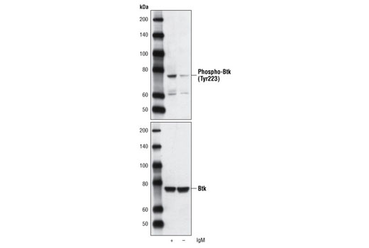 Western blot analysis of extracts from Ramos cells, untreated or treated with anti-human IgM (12 µg/ml for 10 minutes), using Phospho-Btk (Tyr223) Antibody (upper) or Btk (C82B8) Rabbit mAb #3533 (lower).