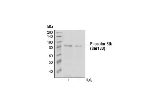 Western blot analysis of extracts from hydrogen peroxide treated or serum starved THP1 cells using Phospho-Btk (Ser180) (3D3) Mouse mAb.