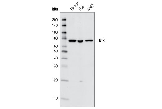 Western blot analysis of extracts from various cell types using Btk (C82B8) Rabbit mAb.
