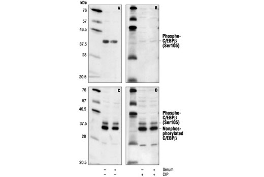 Western blot analysis of extracts from untreated or serum stimulated PC12 cells, using Phospho-C/EBPbeta (Ser105) Antibody (Rat Specific) (A, B) or C/EBPbeta Antibody #3082 (C, D). Nitrocellulose membranes B and D were treated with alkaline phosphatase (CIP) to show the phospho-specificity of Phospho-C/EBPbeta (Ser105) Antibody.