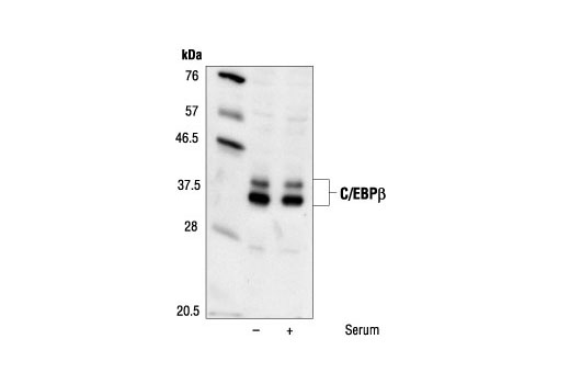 Western blot analysis of extracts from untreated or serum treated PC12 cells, using C/EBPbeta Antibody.