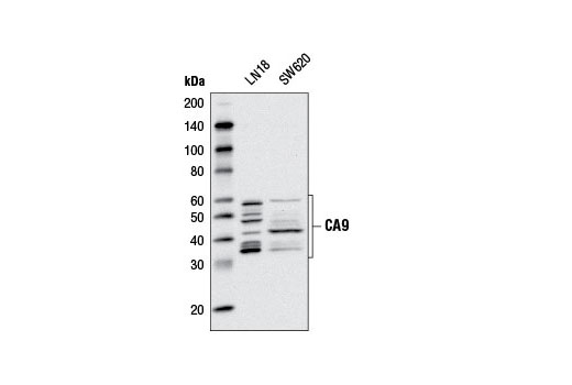 Western blot analysis of extracts from LN18 and SW620 cells using CA9 (D47G3) Rabbit mAb.
