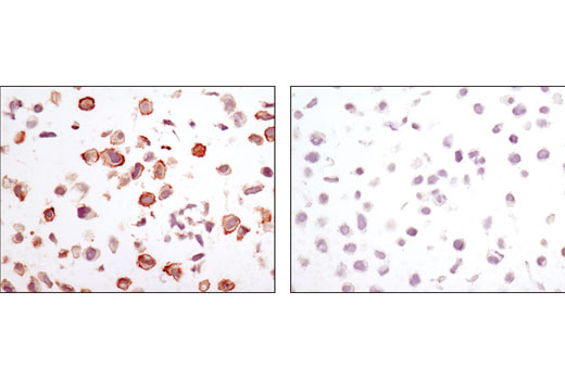 Immunohistochemical analysis of paraffin-embedded cell pellets, LN18 (left) or HeLa (right), using CA9 (D47G3) Rabbit mAb.