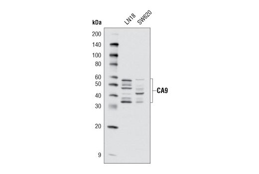 Western blot analysis of total extracts from LN18 and SW620 cells using CA9 (D10C10) Rabbit mAb.