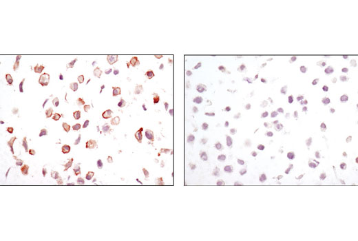 Immunohistochemical analysis of paraffin-embedded cell pellets, LN18 (left) or HeLa (right), using CA9 (D10C10) Rabbit mAb.