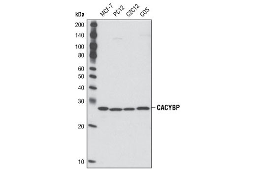Western blot analysis of extracts from various cell lines using CACYBP Antibody.