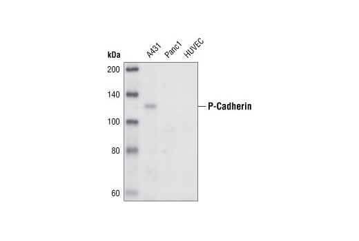 Western blot anlaysis of extracts from A431, Panc1 and HUVE cells, using P-Cadherin Antibody.