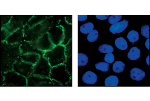 Immunofluorescent analysis of A431 cells, using P-Cadherin Antibody (left). Nuclei in the same cells were stained with DAPI (right).