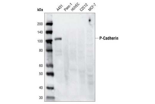 Western blot analysis of extracts from various cell types using P-Cadherin (C13F9) Rabbit mAb.